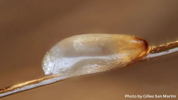 Close-up view of a louse (nit) egg on hair shaft