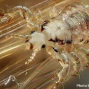 head louse attached to a strand of human hair