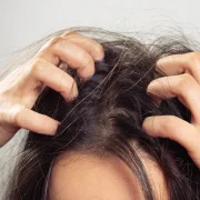 Person itching their head from lice